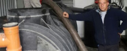 שאיבת מפריד שומנים