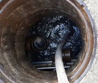 שאיבת בור שומן